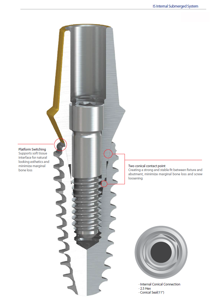 implants screw